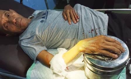 Korban, Agus alami luka bacok di lengan. (Foto:Polres Banjarbaru)